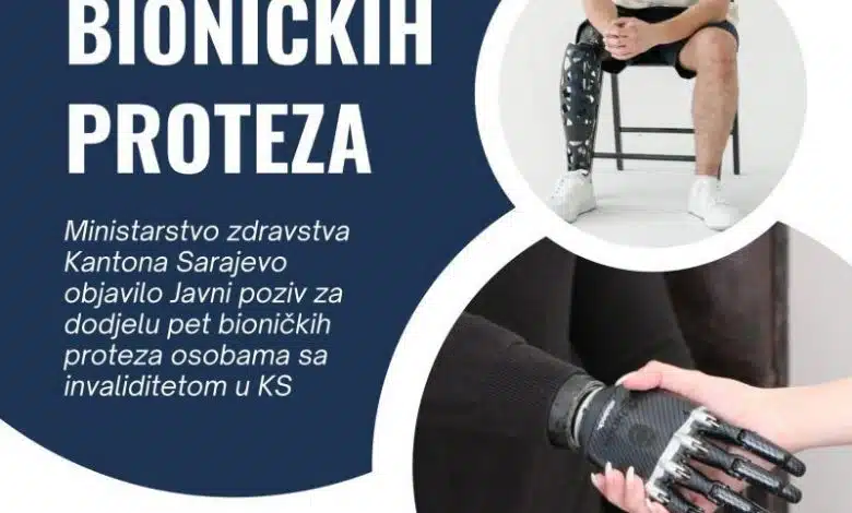Ministarstvo zdravstva KS objavilo javni poziv za dodjelu pet bioničkih proteza osobama s invaliditetom u KS