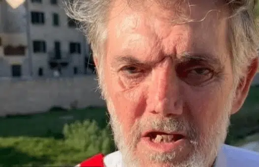 POLDO NOSI TITULU NAJRUŽNIJEG ČOVJEKA NA SVIJETU: Ljepota je ropstvo, a ružnoća vrlina