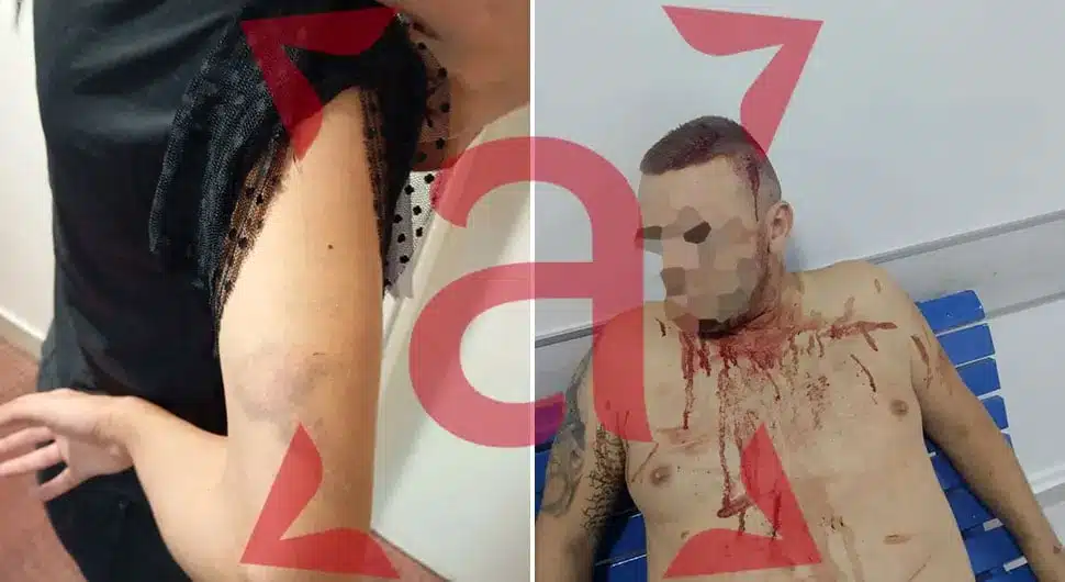 Nakon svadbe, obitelj pretučena, ni djeca nisu pošteđena – Prema TNTportal.ba
