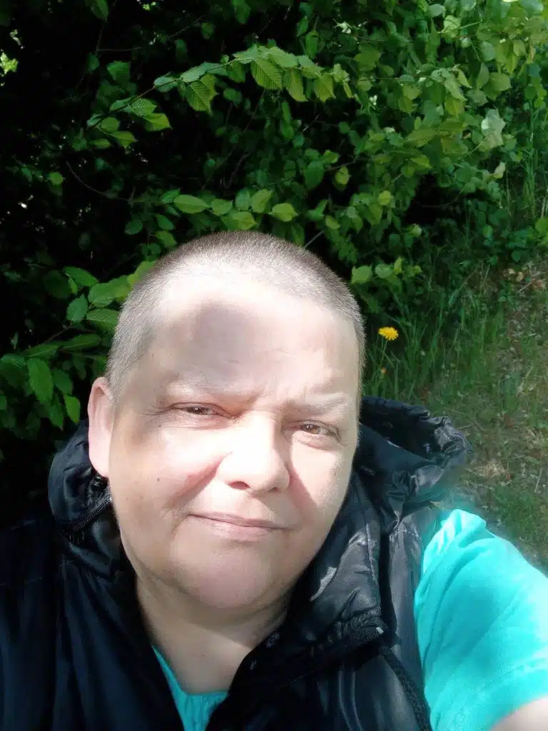 Udruženje Pomozi.ba pokrenulo apel za liječenje Zeničanke Arnele koja vodi bitku sa rakom