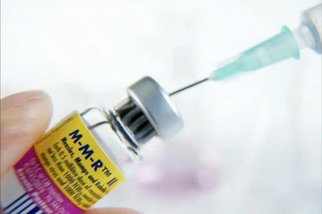 Epidemija morbila proglašena u ZDK-u