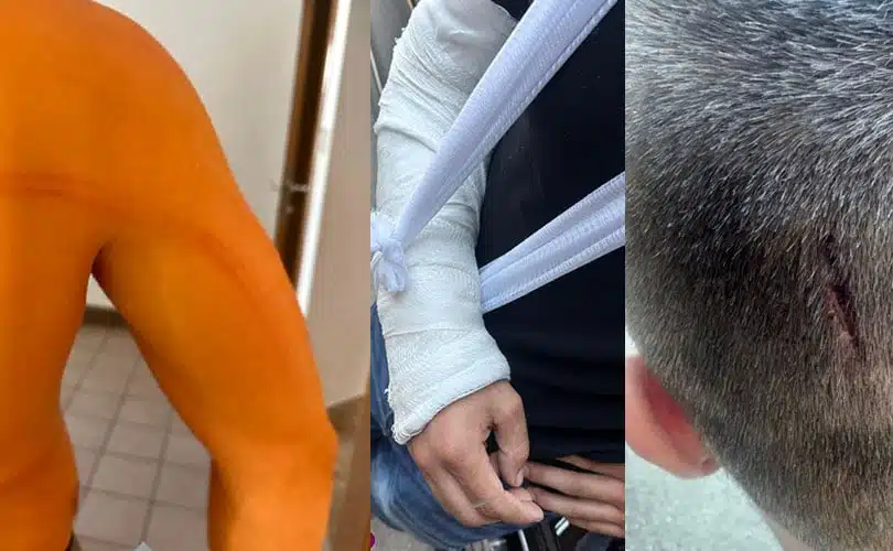 Tvrde mladići da su brutalno pretučeni od strane policije, evo šta nam je saopćeno iz MUP-a ŽZH – TNTportal.ba