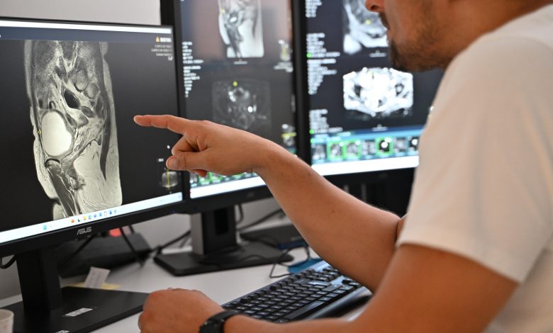 Inovativna metoda u urologiji: ASA Bolnica uvodi revolucionaran pristup za rano otkrivanje raka prostate