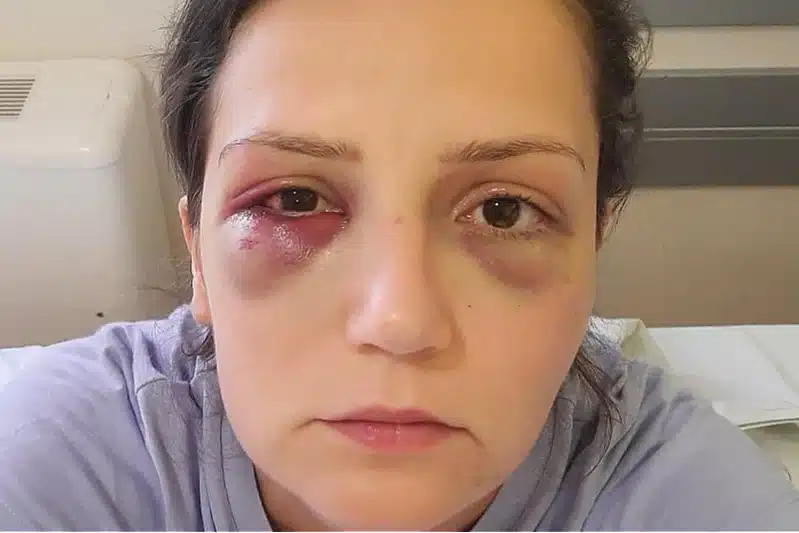 BRUTALNO PRETUKAO RADNICU Ukinuta presuda vlasniku hotela u Jablanici