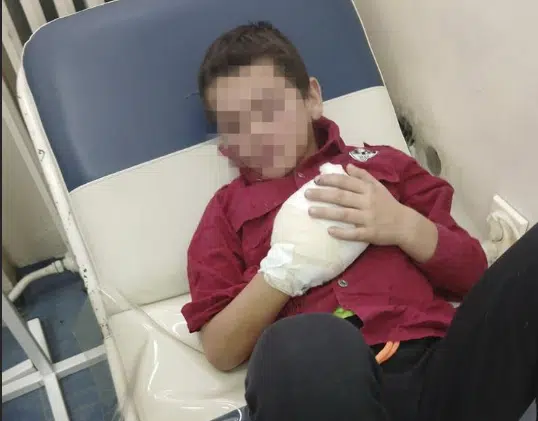 DJEČAKU (8) AMPUTIRANA DVA PRSTA Majka Dragana opisala sve detalje horora: Pola života mi je oduzeo, neki čovjek mu je dao petardu u ruke