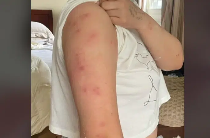 (VIDEO) DOBRO PROVJERITE SOBE! Djevojka prenoćila sa prijateljicama u hotelu, pa doživjela neprijatno iskustvo