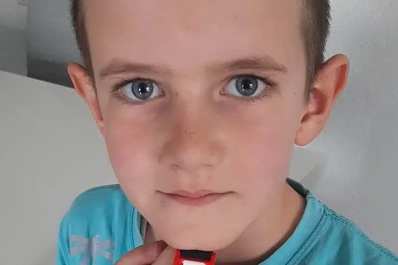 Pomozimo desetogodišnjem Aliji Hercegu da dobije šansu za zdrav i normalan život